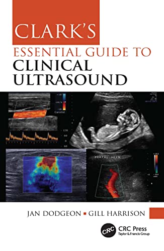 Clark's Essential Guide to Clinical Ultrasound -Original PDF