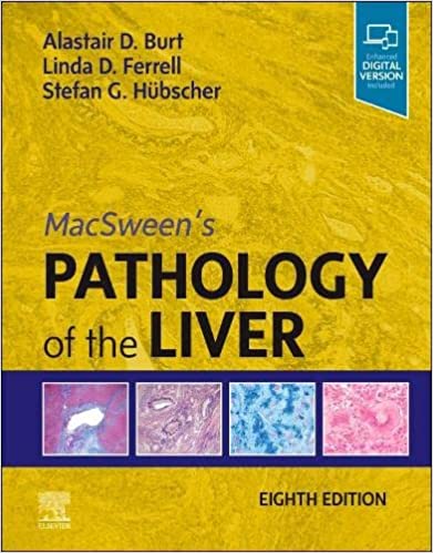 MacSween's Pathology of the Liver 8th Edition-Original PDF