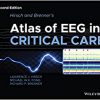 Hirsch and Brenner’s Atlas of EEG in Critical Care 2nd Edition-Original PDF