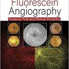 Practical Handbook of Fluorescein Angiography: Posterior Pole and Retinal Periphery -Original PDF