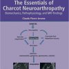 The Essentials of Charcot Neuroarthropathy: Biomechanics, Pathophysiology, and MRI Findings -EPUB