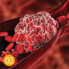 Thrombosis and Thromboembolism 2022-Videos+PDFs