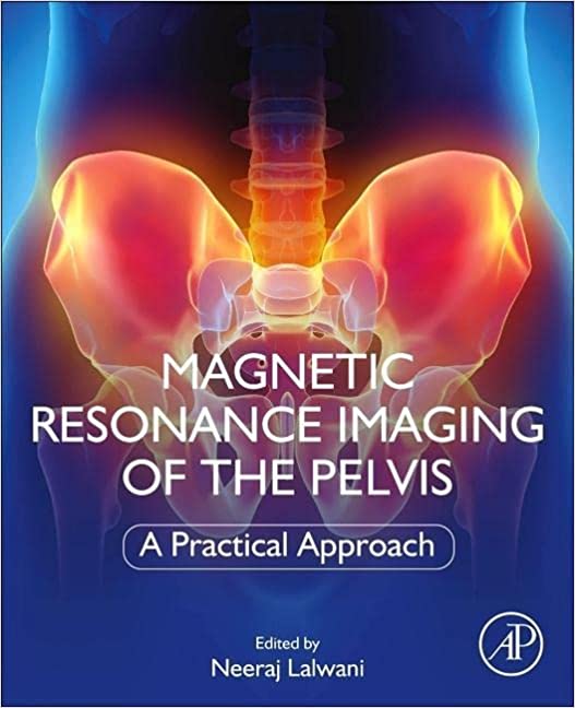 Magnetic Resonance Imaging of The Pelvis: A Practical Approach 1st Edition-True PDF