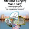 Shoulder Surgery Made Easy!: The Singapore Shoulder and Elbow Society Guide To Arthroscopic And Open Shoulder Procedures -Original PDF