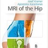 MRI of the Hip-Original PDF