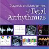 Diagnosis and Management of Fetal Arrhythmias -EPUB+Converted PDF