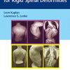 Corrective Osteotomies for Rigid Spinal Deformities -Original PDF