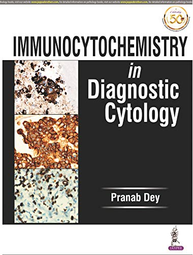 Immunocytochemistry in Diagnostic Cytology -Original PDF
