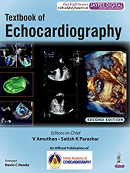 Textbook of Echocardiography 2nd Edition-Original PDF