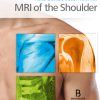 MRI of the Shoulder -Original PDF