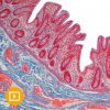 Current Topics in Gastrointestinal and Liver Pathology 2022-Videos + PDFs