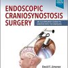 Endoscopic Craniosynostosis Surgery: An Illustrated Guide to Endoscopic Techniques -EPUB