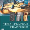 Tibial Plateau Fractures -EPUB