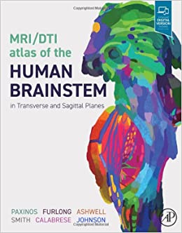 Mri/Dti Atlas of the Human Brainstem in Transverse and Sagittal Planes -EPUB