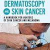 Dermatoscopy and Skin Cancer, updated edition: A handbook for hunters of skin cancer and melanoma -Original PDF