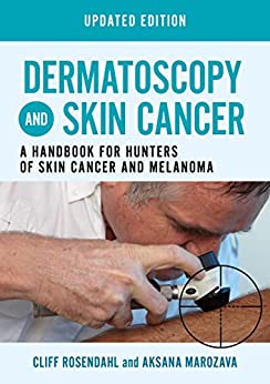 Dermatoscopy and Skin Cancer, updated edition: A handbook for hunters of skin cancer and melanoma -Original PDF