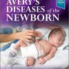 Avery’s Diseases of the Newborn 11th Edition-True PDF