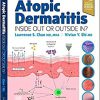 Atopic Dermatitis: Inside Out or Outside In -EPUB