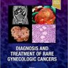 Diagnosis and Treatment of Rare Gynecologic Cancers -EPUB+Converted