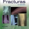 Manual de fracturas/ Handbook of Fractures (Spanish Edition) -Original PDF