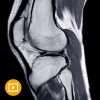 UCSF Neuro and Musculoskeletal Imaging 2022-Videos+PDFs