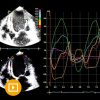 Echocardiography – A Comprehensive Review 2022-Videos+PDFs