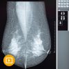 Comprehensive Review of Breast Imaging 2022-Videos+PDFs