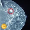 UCSF Breast Imaging 2022-Videos+PDFs
