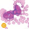 Current Concepts in Hematopathology 2022-Videos+PDFs