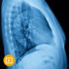 UCSF Thoracic Imaging 2023-Videos+PDFs