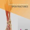 Standards for the Management of Open Fractures -Original PDF