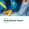 Fast Facts: Early Breast Cancer 2nd edition -Original PDF