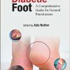 Understanding Diabetic Foot: A Comprehensive Guide For General Practitioners -Original PDF