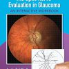 The Optic Nerve Evaluation in Glaucoma: An Interactive Workbook -Original PDF