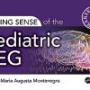 Making Sense of the Pediatric EEG -Original PDF