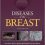Diseases of the Breast 5th Edition-Original PDF