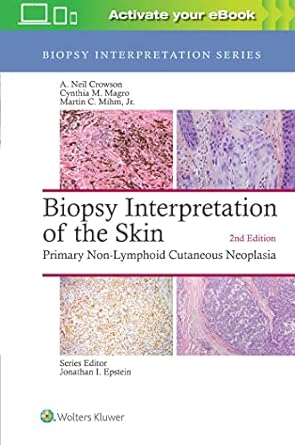 Biopsy Interpretation of the Skin: Primary Non-Lymphoid Cutaneous Neoplasia (Biopsy Interpretation Series) 2nd Edition-Original PDF