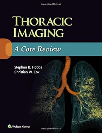 Thoracic Radiology: A Core Review -Original PDF
