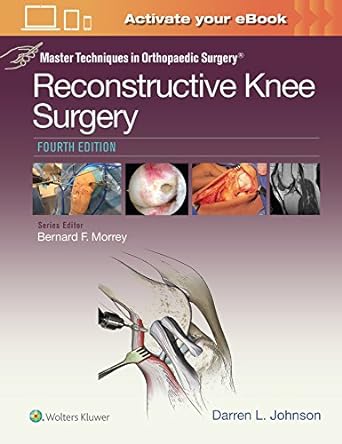 Master Techniques in Orthopaedic Surgery: Reconstructive Knee Surgery 4th Edition-Original PDF