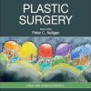 Plastic Surgery: Volume 6: Hand and Upper Limb 5th Edition-True PDF