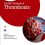 The ESC Textbook of Thrombosis (The European Society of Cardiology Series) -Original PDF