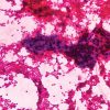Advances in Cytology and Small Biopsies 2023-Videos+PDFs