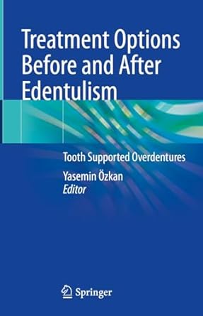 Treatment Options Before and After Edentulism: Tooth Supported Overdentures -Original PDF