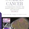 Ovarian Cancer: The “Gynaecological Challenge” from Diagnostic Work-Up to Cytoreduction and Chemotherapy. Volume 2 -Original PDF