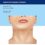 Neck Rejuvenation: Surgical and Nonsurgical Techniques -Original PDF