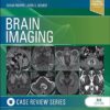 Brain Imaging: Case Review Series 3rd Edition-Original PDF