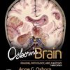 Osborn’s Brain E-Book -EPUB+Converted PDF