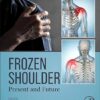 Frozen Shoulder: Present and Future -EPUB