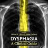 Dysphagia: A Clinical Guide -EPUB