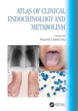Atlas of Clinical Endocrinology and Metabolism -Original PDF